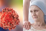 Liūdna padėtis: sergantieji vėžiu Lietuvoje nemokamai gali gauti vos ketvirtadalį inovatyvių vaistų