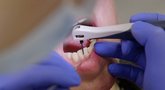 Gydytojai įspėja: neteisinga burnos higiena gali sukelti daug ligų visame organizme (nuotr. stop kadras)
