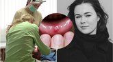 Skaudi žaizdelė burnoje gali išduoti nemalonią ligą (nuotr. 123rf.com)