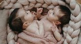 Gimusios Siamo dvynės nustebino net medikus: štai, kaip jos atrodo dabar (nuotr. facebook.com)