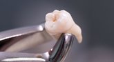 Protiniai dantys  (nuotr. Shutterstock.com)