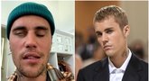 Justinas Bieberis prabilo apie veido paralyžių: įžvelgė tik vieną (nuotr. Instagram)