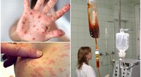 Lietuvoje plinta užkrečiama infekcija  