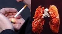 Dėmesio, rūkaliai: atskleidė, kokiame amžiuje metus rūkyti dar galima susigrąžinti sveikatą (nuotr. SCANPIX) tv3.lt fotomontažas