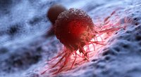 Vėžio ląstelės  (nuotr. 123rf.com)