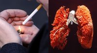 Plaučių ligos – dažniausia rūkymo pasekmė (nuotr. SCANPIX) tv3.lt fotomontažas