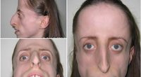 Po nosies operacijos moteriai pirmąkart padarė makiažą: jautėsi pati gražiausia   