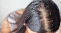 Plaukų slinkimas (nuotr. Shutterstock.com)