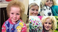 Dešimtmetė mergaitė išmoko džiaugtis savo pasišiaušusiais „vaikiškais plaukais“, dėl kurių kiek primena Einšteiną (nuotr. facebook.com)