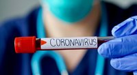 Koronavirusas  (nuotr. Shutterstock.com)