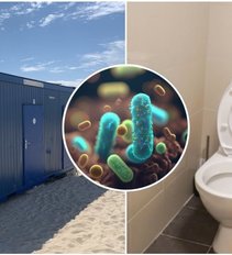 Ar viešuose Lietuvos tualetuose galima užsikrėsti ŽIV ir sifiliu? Atskleidė tiesą