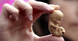 Skubina daryti abortą užuot padėję? Gydytojus papiktino tokie kaltinimai