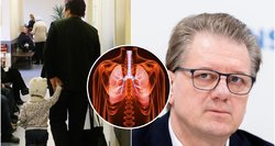 Profesorius Čaplinskas – apie plintantį „baltųjų plaučių“ sindromą: štai kam pavojingiausia