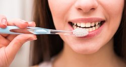 Šias dantų priežiūros klaidas darote kiekvieną dieną: nekartokite jų 