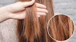 Šiukštu nenaudokite šios plaukų priemonės: kelia pavojų sveikatai(nuotr. Shutterstock.com)