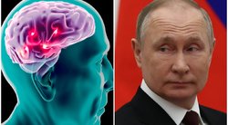 Netyla kalbos dėl Putino sveikatos  