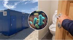 Ar viešuose Lietuvos tualetuose galima užsikrėsti ŽIV ir sifiliu? Atskleidė tiesą (nuotr. 123rf.com, tv3.lt)  
