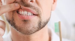 Mitai apie dantų ėduonį: ar tikrai kalti saldumynai ir netinkama pasta? (nuotr. Shutterstock.com)