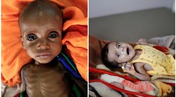 Širdį veriantys vaizdai: alkio ir ligų iškankinti vaikai net nebegali verkti (nuotr. SCANPIX)