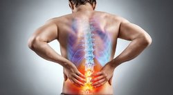 Staigus nugaros skausmas gali išduoti skaudžią ligą: pasitikrinkite laiku (nuotr. Shutterstock.com)