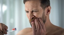 TOP6 priežastys, kodėl kraujuoja dantenos: įsidėmėkite (nuotr. Shutterstock.com)