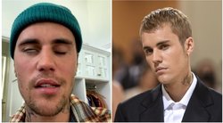 Justinas Bieberis prabilo apie veido paralyžių: įžvelgė tik vieną (nuotr. Instagram)