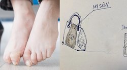 Moters prašymas šokiruoja: nori, kad iš jos amputuotos kojos kai ką pagamintų (nuotr. socialinių tinklų)
