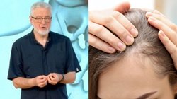 Unikauskas atskleidė, kaip sustabdyti plaukų slinkimą: išbandykite  