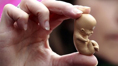 Prahos ligoninė per klaidą moteriai atliko abortą  (nuotr. SCANPIX)