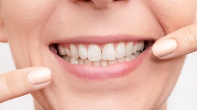 Sveika šypsena (nuotr. Shutterstock.com)