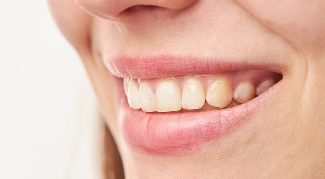 Sapne iškrenta dantis? Gydytoja paaiškino, ką tai reiškia (nuotr. Shutterstock.com)