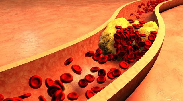 1 produktą vadina aukso gysla organizmui: gali sumažinti net aukštą cholesterolį (nuotr. 123rf.com)