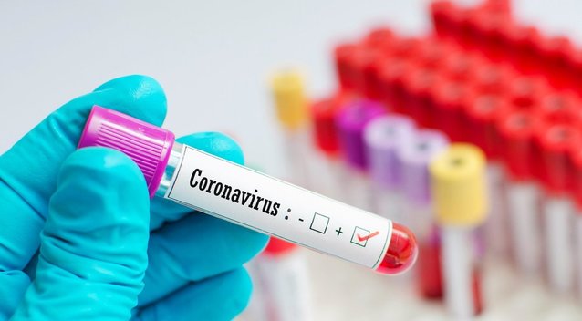 Per parą Lietuvoje nustatyta 114 koronaviruso atvejų  (nuotr. 123rf.com)