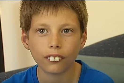  Dėl „triušio“ dantų pravardžiuotas berniukas parodė naują šypseną (nuotr. YouTube)