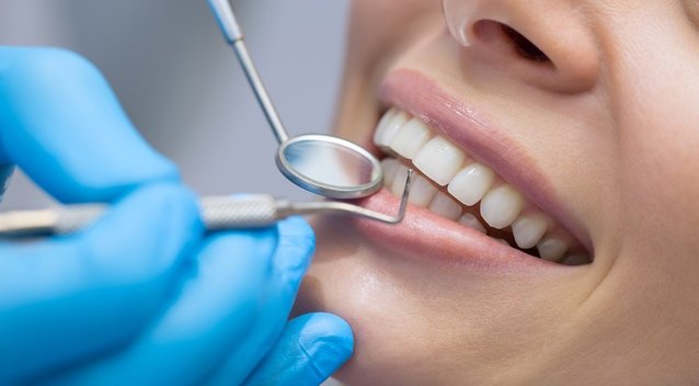 Norite turėti baltus dantis? Tuomet niekada nevalgykite šių 5 produktų (nuotr. Shutterstock.com)