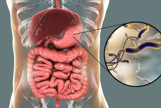 Helicobacter Pylori  (nuotr. Shutterstock.com)