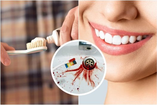 Keturi ženklai parodantys, kad dantis valote per stipriai (tv3.lt fotomontažas)