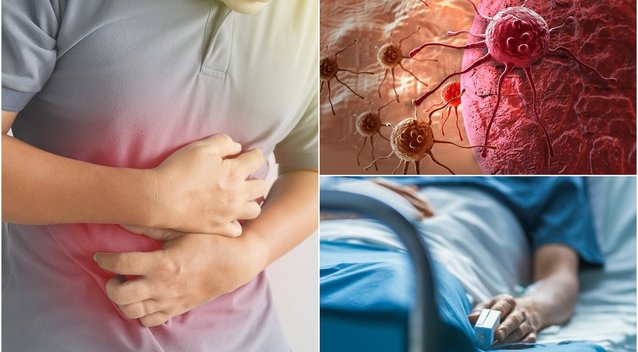 Simptomų šis vėžys gali nerodyti: aptikti gali padėti paprastas testas namuose (nuotr. Shutterstock.com)