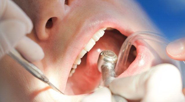 Įspėja nekartoti šių klaidų einant pas odontologą: prisidarysite sau gėdos (nuotr. 123rf.com)