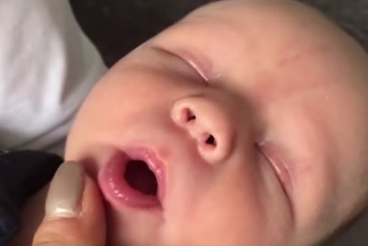 Išvydę šį kūdikį savo akimis negalėjo patikėti ne tik tėvai, bet ir medikai  
