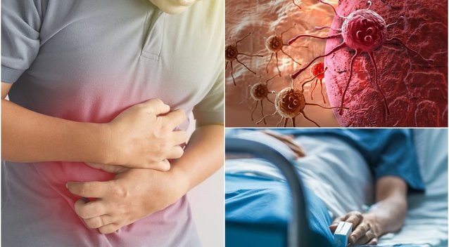 Žarnyno vėžį išduoda vos keli simptomai: ragina pastebėti kuo greičiau  (nuotr. Shutterstock.com)