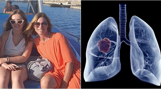 Plaučių vėžiu susirgusi 49-erių mokytoja įvardijo simptomus: įsidėmėkite (Nuotr. facebook.com ir 123rf.com)  