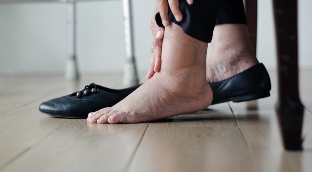 Tinstančios kojos (nuotr. Shutterstock.com)