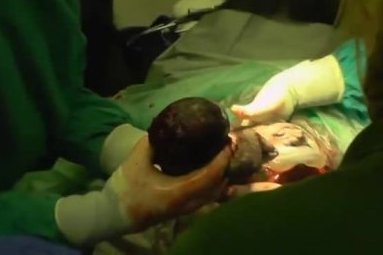 Tikras stebuklas: mažylė goriliukė išgyveno sunkią Cezario operaciją (nuotr. TV3)
