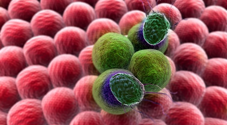 Vėžinės ląstelės (nuotr. Fotolia.com)