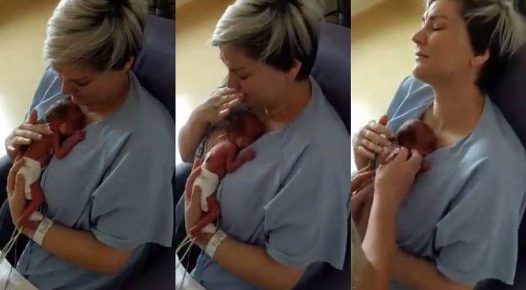 Motina pirmą kartą prie savęs glaudžia neišnešiotą kūdikį (nuotr. iš vaizdo įrašo)