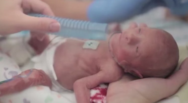 Išvydusį gimusį kūdikį motina neteko sąmonės: sujaudins iki širdies gelmių (nuotr. YouTube)
