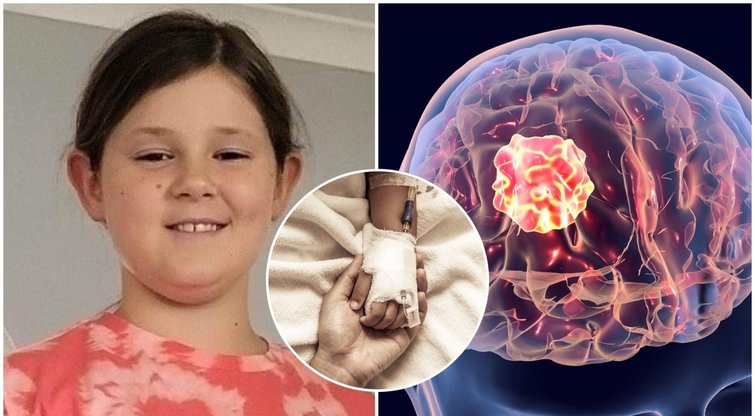 Smegenų vėžį 10-metei išdavė vos 1 simptomas: įspėja kitus (nuotr. tv3.lt fotomontažas)  