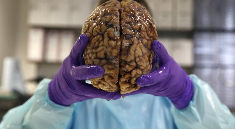 Žmogaus smegenys (nuotr. SCANPIX)