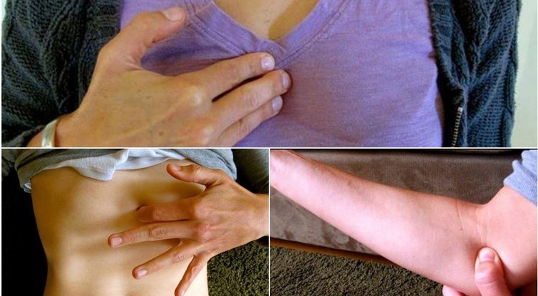 Kūno taškai, kuriuos spaudžiant, mažėja stresas (nuotr. facebook.com)